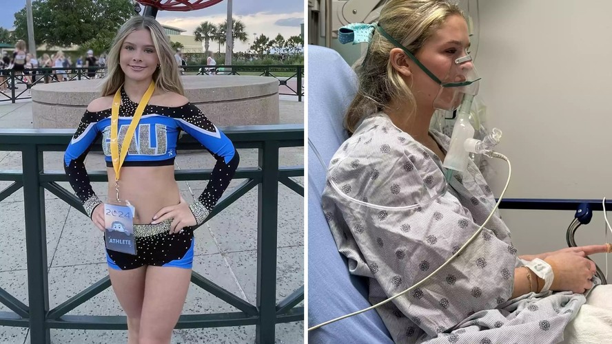 Brianne Cullen descobriu o diagnóstico de 'pulmão de pipoca' após anos fumando vape