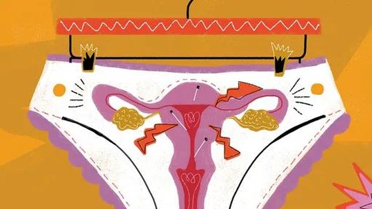 Endometriose e ovário policístico: entenda as diferenças