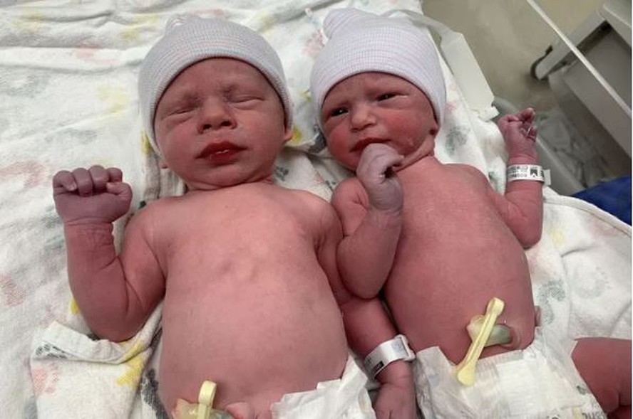Mulher dá à luz a gêmeos de embriões congelados há 30 anos