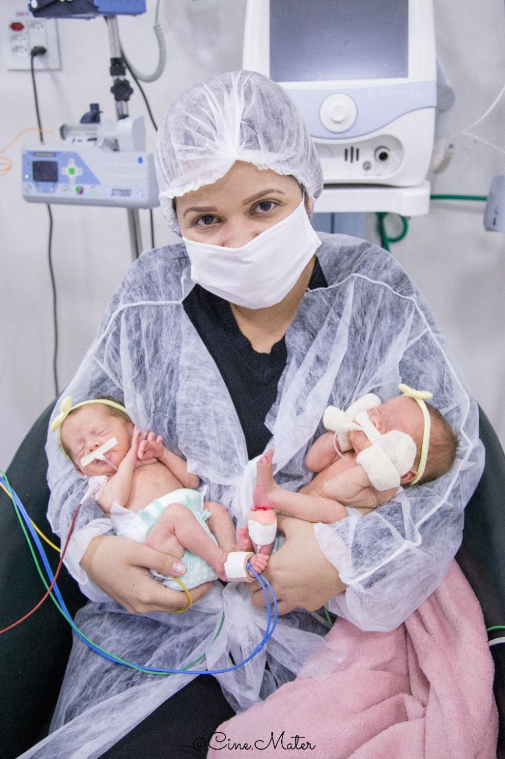 Jade e Pérola, mesmo na UTI, foram amamentadas pelo leite da mãe via sonda — Foto: Arquivo pessoal