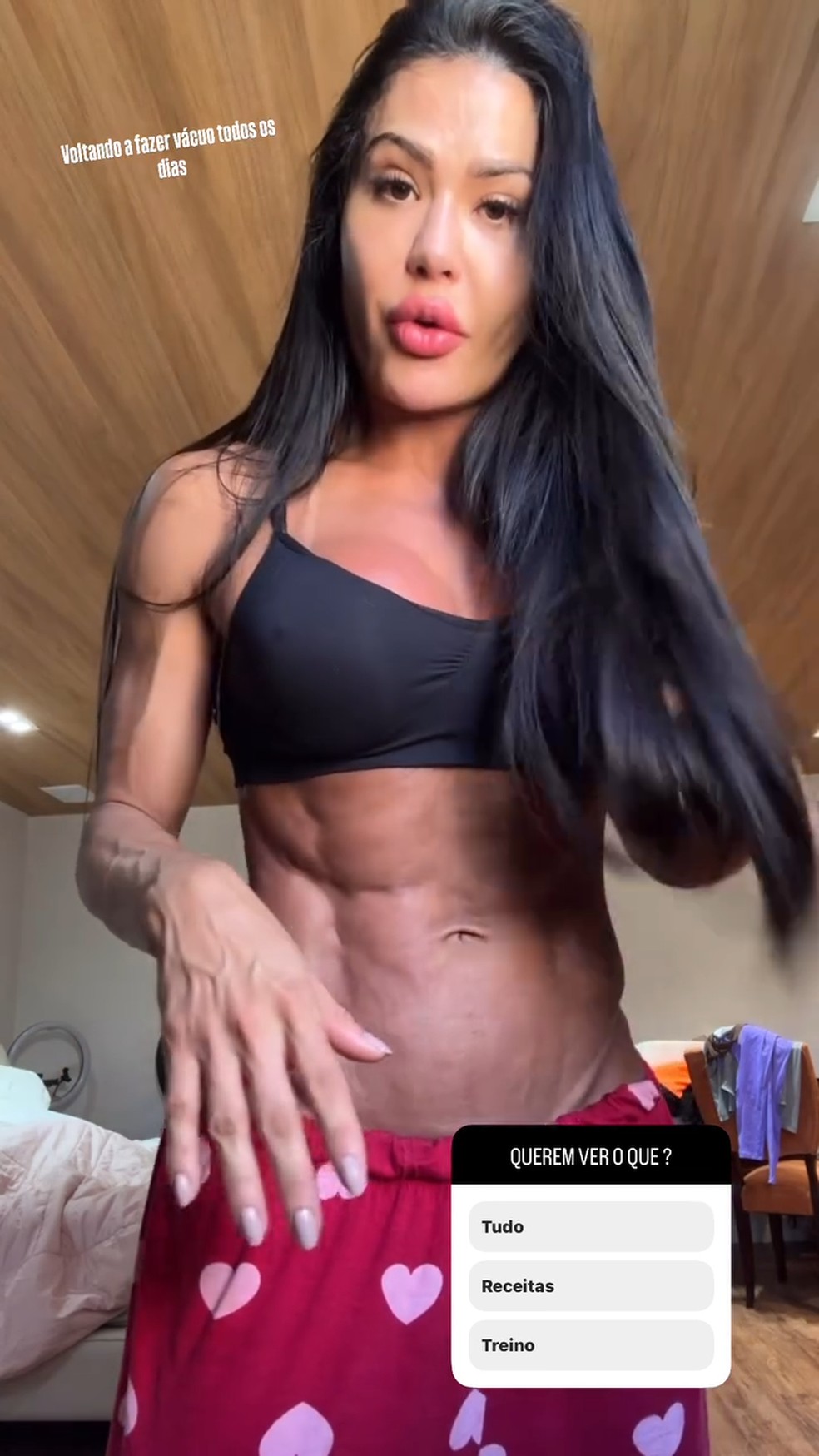 Gracyanne Barbosa mostra mudança no corpo após dormir de cinta — Foto: Reprodução/ Instagram