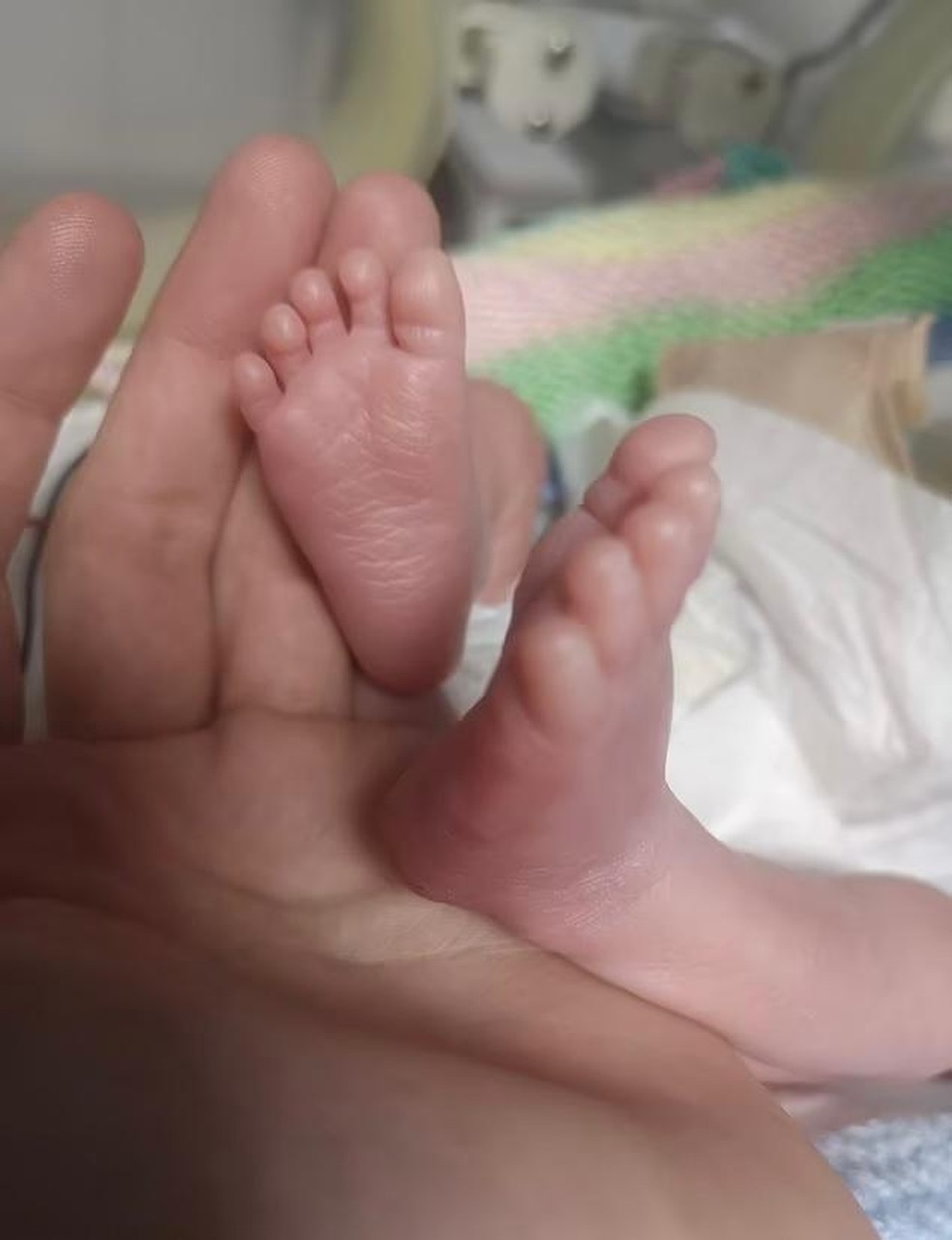 Bebê de 24 semanas e 780 gramas nasce com vida — Foto: Hannah Cole/SWNS