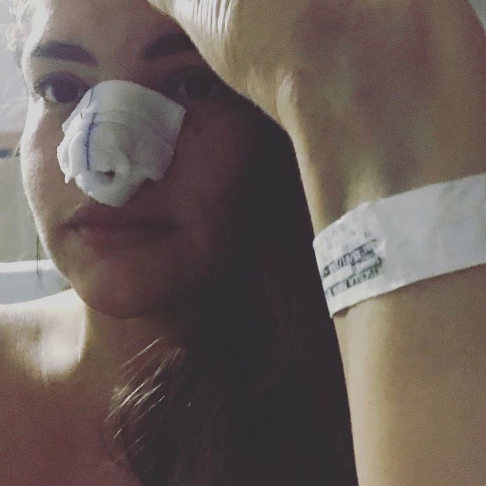 Priscilla Aguiar quase ficou cega devido a complicações com uma rinomodelação — Foto: Reprodução/Instagram @prillaguiar