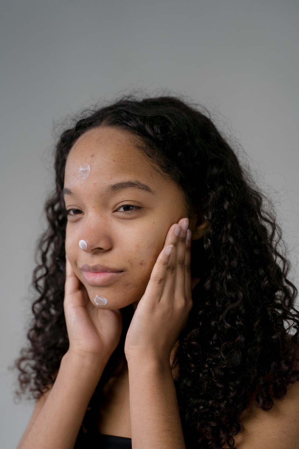 Como reconhecer o caso de acne hormonal  — Foto: Reprodução Pexels