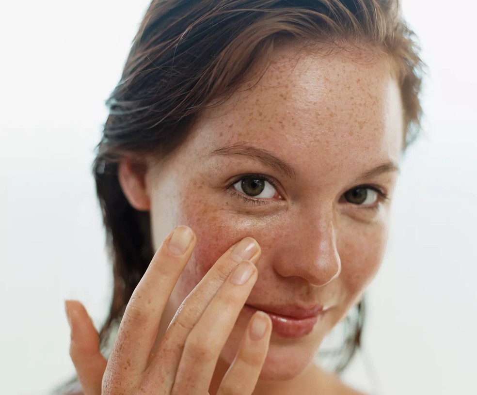 6 hábitos de cuidados com a pele para evitar e reduzir manchas — Foto: Getty Images