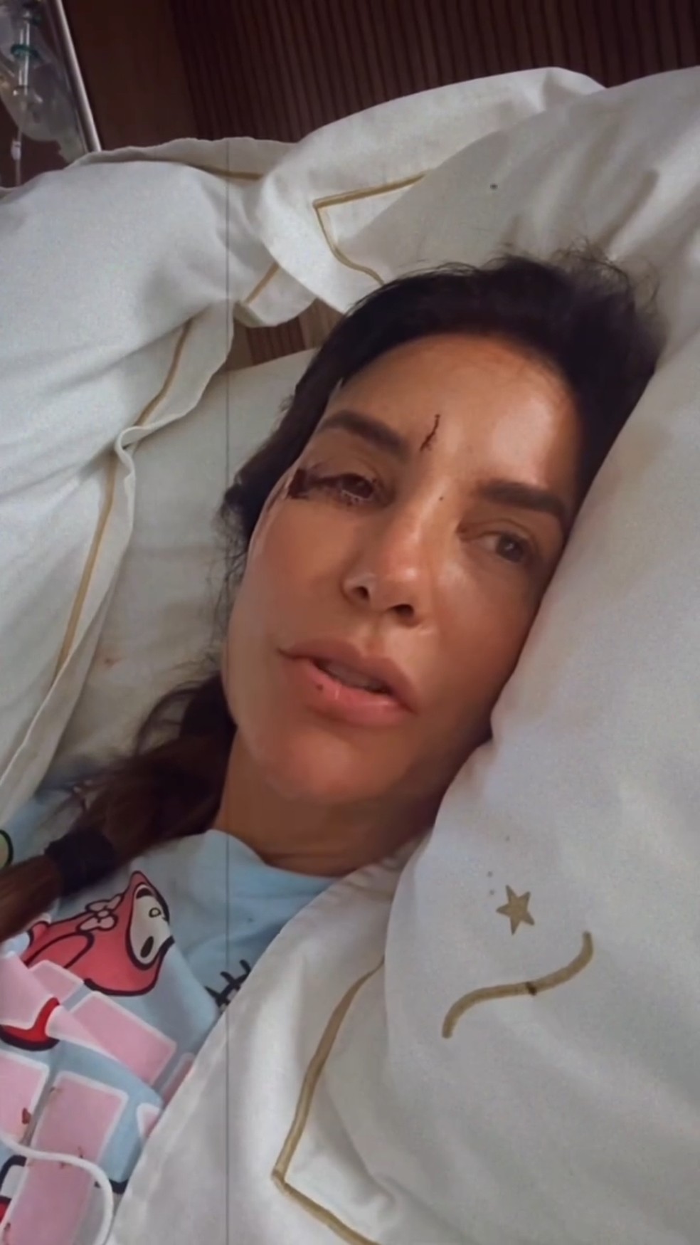 Ivete Sangalo mostrou o rosto após desmaio e fratura — Foto: Reprodução/ Divulgação