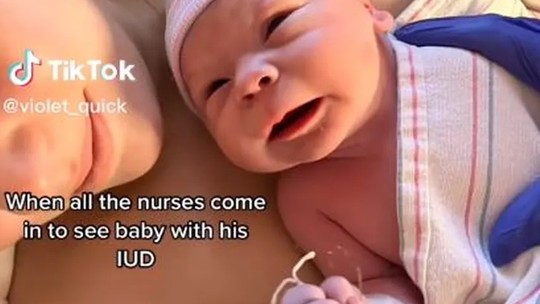 Por que há relatos (e imagens) de bebês que nascem com o DIU na mão?