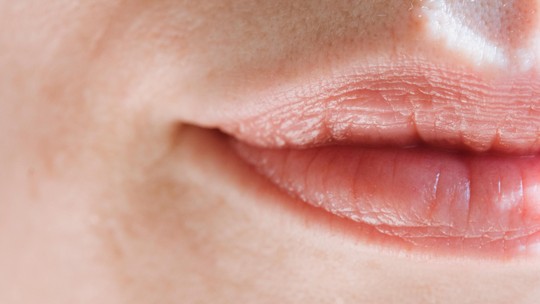 10 hidratantes labiais para acabar com o ressecamento causado pelo frio