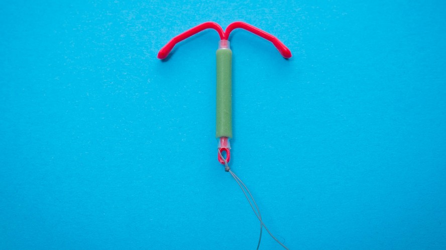 DIU: É preciso fazer repouso depois de retirar o dispositivo intrauterino?