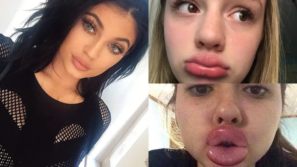 Empresária influenciou o 'Kylie Jenner Lip Challenge' quando era mais jovem — Foto: Reprodução/ Instagram