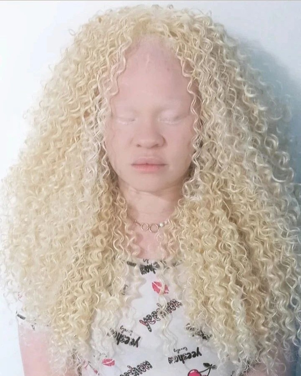 Thielle Luize faz conteúdo sobre albinismo nas redes — Foto: Reprodução / Instagram