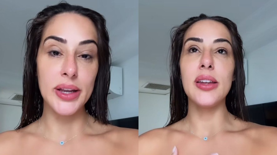 Anny, do 'BBB24', revela condição e mostra o rosto inchado: 'Fico sem ...