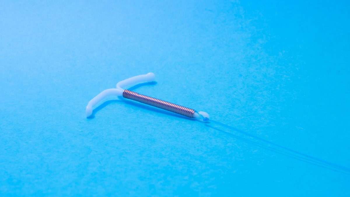 Como colocar o DIU pelo Sistema Único de Saúde (SUS)?