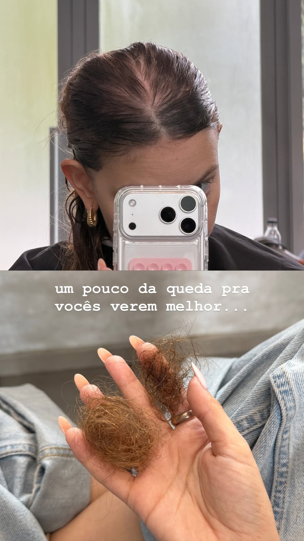 Bruna Furlan conta que queda de cabelo aumentou em nova fase do tratamento do câncer — Foto: Reprodução/Instagram
