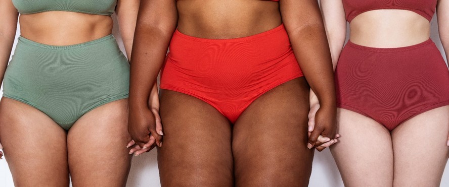 Lipedema: 5 verdades que você precisa saber