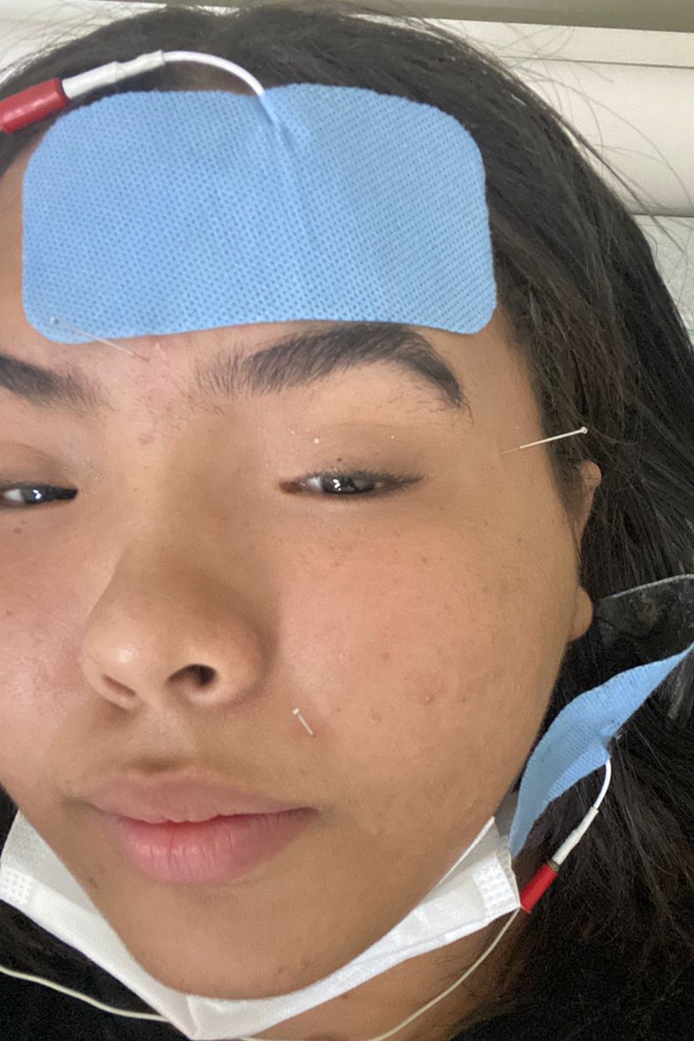 Dias fez 25 sessões de fisioterapia — Foto: Arquivo pessoal