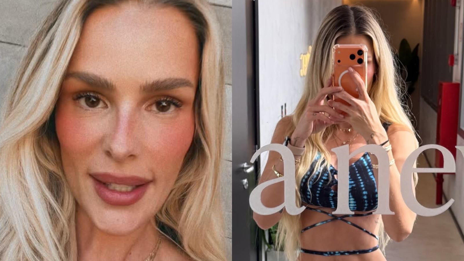 Yasmin Brunet detalha rotina de exercícios para controlar sintomas de lipedema