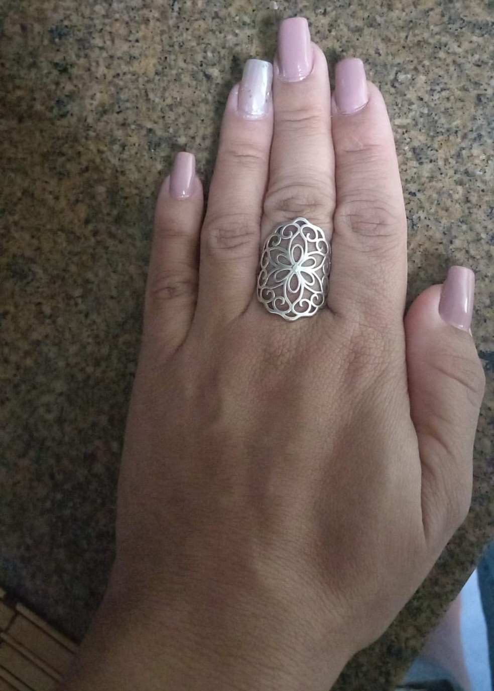 Reis diz que as mãos aumentaram de tamanho, a ponto de não conseguir usar pulseiras  — Foto: Arquivo pessoal