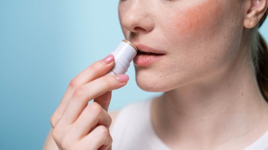 Hidratante labial dá alergia? Saiba o que dizem especialistas